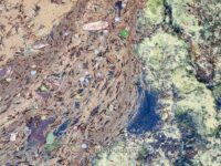Crim Dell Surface Art – April 2022 #41140